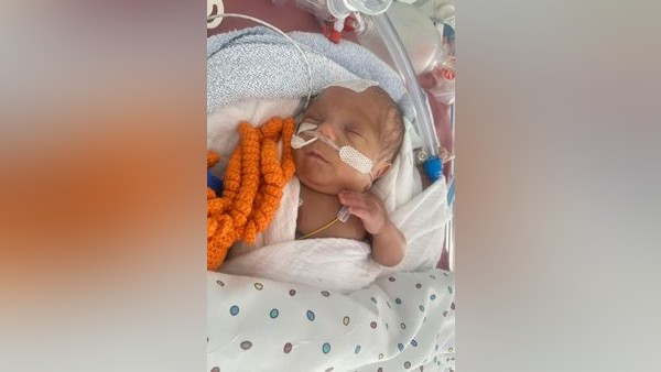 Spektakulär: Drillinge im St. Vinzenz - „jede Sekunde zählte“